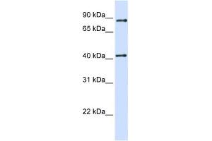 WB Suggested Anti-TXNDC13 Antibody Titration:  0. (TMX4 Antikörper  (C-Term))