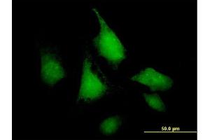 Immunofluorescence of purified MaxPab antibody to SNF1LK on HeLa cell. (SIK1 Antikörper  (AA 1-783))