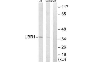 Western Blotting (WB) image for anti-Ubiquitin Protein Ligase E3 Component N-Recognin 1 (UBR1) (Internal Region) antibody (ABIN1851278)