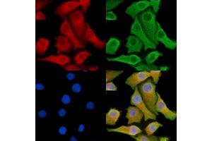 ABIN7095288 and ABIN7099345 staining Hela cells by IF/ICC. (SOCS5 Antikörper)