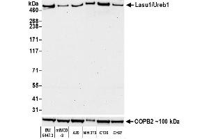 Western Blotting (WB) image for anti-HECT, UBA and WWE Domain Containing 1, E3 Ubiquitin Protein Ligase (HUWE1) (AA 2250-2300) antibody (ABIN7455157)