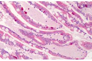 Human Small Intestine: Formalin-Fixed, Paraffin-Embedded (FFPE) (C1QTNF4 Antikörper  (C-Term))