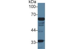 Detection of IkBz in Mouse Liver lysate using Polyclonal Antibody to Inhibitory Subunit Of NF Kappa B Zeta (IkBz) (Inhibitory Subunit of NF-KappaB zeta (AA 414-654) Antikörper)