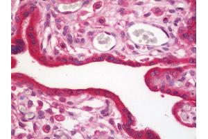 Anti-PFDN1 antibody IHC staining of human placenta.