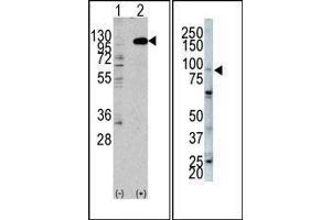 (LEFT) Western blot analysis of anti-hFGFR2-C808 Pab in 293 cell line lysates transiently transfected with the FGFR2 gene (2ug/lane). (FGFR2 Antikörper  (C-Term))