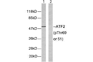 Western blot analysis of extracts from LOVO cells. (ATF2 Antikörper  (pThr51, pThr69))