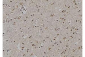 ABIN6269295 at 1/100 staining Human brain tissue by IHC-P. (14-3-3 zeta Antikörper  (Internal Region))