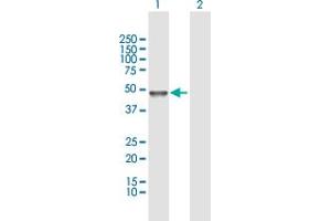 Western Blot analysis of TUBAL3 expression in transfected 293T cell line by TUBAL3 MaxPab polyclonal antibody. (TUBAL3 Antikörper  (AA 1-406))