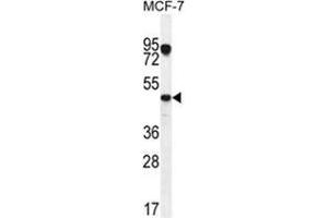 VEGF3 Antibody (N-term) western blot analysis in MCF-7 cell line lysates (35 µg/lane).