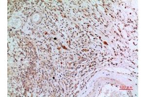 Immunohistochemistry (IHC) analysis of paraffin-embedded Human Brain, antibody was diluted at 1:100. (CD3D Antikörper  (Internal Region))