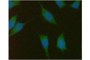 ICC/IF analysis of PMVK in PC3 cells line, stained with DAPI (Blue) for nucleus staining and monoclonal anti-human PMVK antibody (1:100) with goat anti-mouse IgG-Alexa fluor 488 conjugate (Green). (PMVK Antikörper  (AA 1-192))