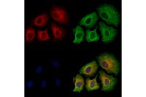 ABIN6256390 and ABIN6267486 staining Hela cells(4h of LPS treatment) by IF/ICC. (IRS1 Antikörper  (pSer639))