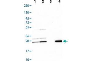 Western blot analysis of Lane 1: Human cell line RT-4 Lane 2: Human cell line U-251MG sp Lane 3: Human plasma (IgG/HSA depleted) Lane 4: Human liver tissue with CMPK1 polyclonal antibody  at 1:100-1:250 dilution.