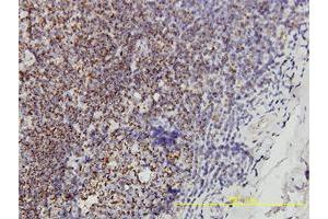 Immunohistochemistry (Formalin-fixed Paraffin-embedded Sections) (IHC (fp)) image for anti-Prohibitin (PHB) (AA 1-272) antibody (ABIN562206)
