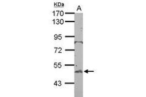 Image no. 1 for anti-BTB (POZ) Domain Containing 10 (BTBD10) (AA 188-436) antibody (ABIN1501880) (BTBD10 Antikörper  (AA 188-436))