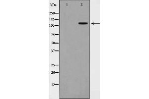 Western blot analysis on COS7 cell lysate using XRN2 Antibody,The lane on the left is treated with the antigen-specific peptide. (XRN2 Antikörper)
