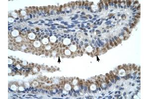 ZNF683 antibody was used for immunohistochemistry at a concentration of 4-8 ug/ml to stain Epithelial cells of intestinal villus {arrows) in Human Intestine. (ZNF683 Antikörper  (N-Term))