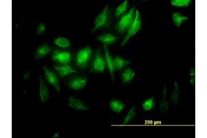 Immunofluorescence of monoclonal antibody to NME2 on HeLa cell. (NME2 Antikörper  (AA 51-152))