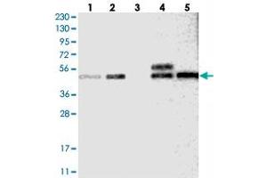 Western blot analysis of Lane 1: RT-4, Lane 2: U-251 MG, Lane 3: Human Plasma, Lane 4: Liver, Lane 5: Tonsil with SLC43A1 polyclonal antibody .