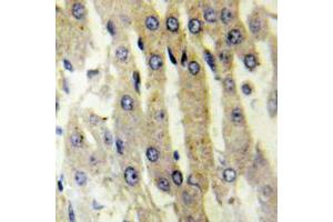 Immunohistochemical analysis of ACAD10 staining in human liver formalin fixed paraffin embedded tissue section. (ACAD10 Antikörper  (Center))