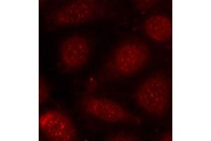 Immunofluorescence staining of methanol-fixed MCF-7 cells using Phospho-PRKCB-T641 antibody (ABIN2987563). (PKC beta Antikörper  (pThr641))