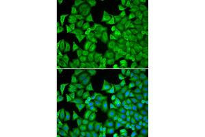 Immunofluorescence analysis of MCF-7 cell using RRM1 antibody. (RRM1 Antikörper)