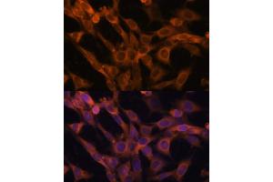 Immunofluorescence (IF) image for anti-RAB21, Member RAS Oncogene Family (RAB21) (AA 1-225) antibody (ABIN6146556)