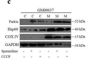 Spermidine affected the accumulation of PINK1 and translocation of Parkin.
