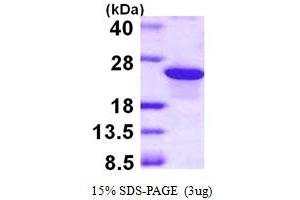 SDS-PAGE (SDS) image for ADP-Ribosylation Factor-Like 5B (ARL5B) (AA 1-179) protein (His tag) (ABIN667512)
