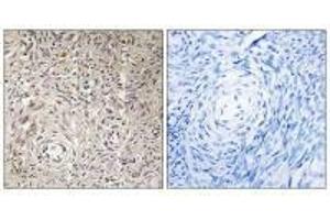 Immunohistochemistry analysis of paraffin-embedded human ovary tissue using GCNT7 antibody. (GCNT7 Antikörper)