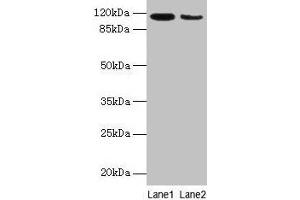 Western blot All lanes: ATP2A2 antibody at 6 μg/mL Lane 1: Mouse heart tissue Lane 2: Mouse skeletal muscle tissue Secondary Goat polyclonal to rabbit IgG at 1/10000 dilution Predicted band size: 115, 110, 112 kDa Observed band size: 115 kDa (ATP2A2 Antikörper  (AA 314-756))