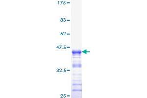 Neurofibromin 1 Protein (NF1) (AA 2719-2818) (GST tag)