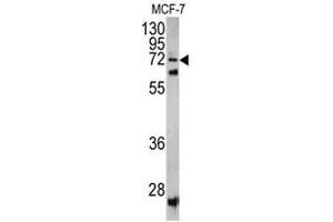 Western blot analysis of SCFD1 antibody (C-term) in MCF-7 cell line lysates (35ug/lane). (SCFD1 Antikörper  (C-Term))