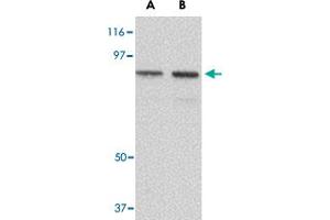 Western blot analysis of NUP107 in A-549 cell lysate with NUP107 polyclonal antibody  at (A) 1 and (B) 2 ug/mL .