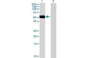 Lane 1: BMPR1B transfected lysate ( 55. (BMPR1B 293T Cell Transient Overexpression Lysate(Denatured))
