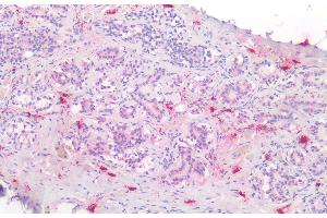 Immunohistochemistry (IHC) image for anti-Tryptase alpha/beta 1 (TPSAB1) (AA 161-262) antibody (ABIN7433105)