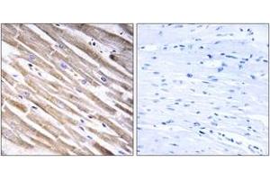 Immunohistochemistry analysis of paraffin-embedded human heart tissue, using RPL3L Antibody. (RPL3L Antikörper  (AA 211-260))