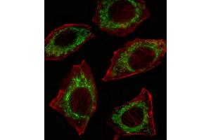 Fluorescent confocal image of A549 cell stained with ALDH2 Antibody (N-term). (ALDH2 Antikörper  (N-Term))