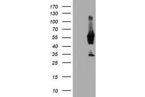 Western Blotting (WB) image for anti-N-Myristoyltransferase 2 (NMT2) antibody (ABIN1499782) (NMT2 Antikörper)