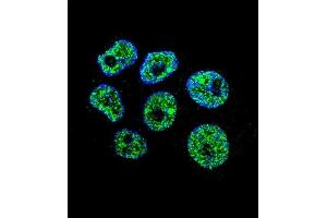 Confocal immunofluorescent analysis of WDR42C Antibody (N-term) (ABIN655843 and ABIN2845256) with ZR-75-1 cell followed by Alexa Fluor 488-conjugated goat anti-rabbit lgG (green). (DCAF8L2 Antikörper  (N-Term))