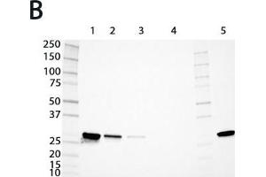 Expression analysis of rat GSTs of the mu and alpha classes. (GSTM4 Antikörper  (AA 21-215))