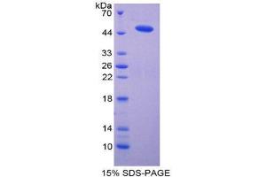 SDS-PAGE (SDS) image for Microsomal Glutathione S-Transferase 1 (MGST1) (AA 8-155) protein (His tag,GST tag) (ABIN1980793)