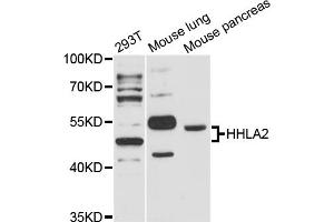 Western blot analysis of extracts of various cell lines, using HHLA2 antibody (ABIN6293271) at 1:3000 dilution. (HHLA2 Antikörper)