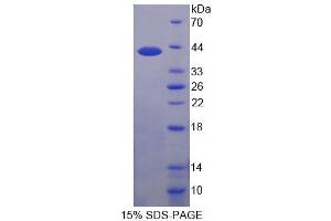 SDS-PAGE (SDS) image for Pim-3 Oncogene (PIM3) (AA 1-326) protein (His tag) (ABIN6236492) (PIM3 Protein (AA 1-326) (His tag))