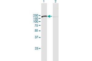 Western Blot analysis of SMC3 expression in transfected 293T cell line by SMC3 MaxPab polyclonal antibody. (SMC3 Antikörper  (AA 1-1217))