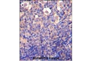KLRC2 Antibody (N-term) (ABIN652570 and ABIN2842383) immunohistochemistry analysis in formalin fixed and paraffin embedded human tonsillitis tissue followed by peroxidase conjugation of the secondary antibody and DAB staining.