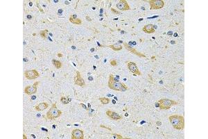 Immunohistochemistry of paraffin-embedded Mouse brain using FASTKD1 Polyclonal Antibody at dilution of 1:100 (40x lens).
