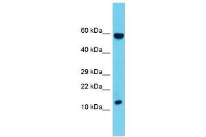 Host: Rabbit  Target Name: Cd247  Sample Tissue: Rat Thymus lysates  Antibody Dilution: 1. (CD247 Antikörper  (C-Term))