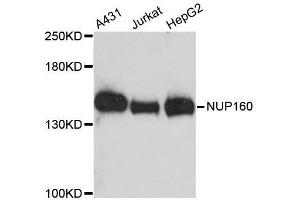 Western blot analysis of extracts of various cell lines, using NUP160 antibody. (NUP160 Antikörper  (AA 40-150))