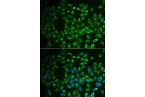 Immunofluorescence analysis of A549 cell using FABP6 antibody. (FABP6 Antikörper)